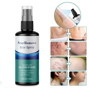 Scar Removal Spray 50ml